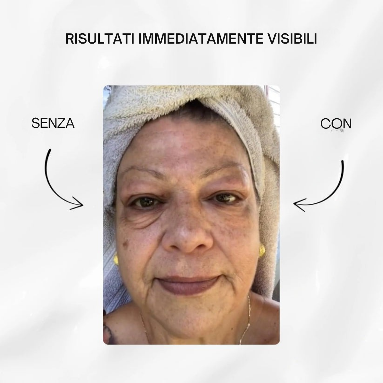 V-LIFT OCCHI