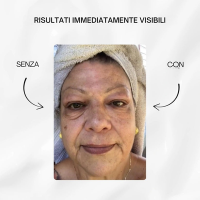 V-LIFT OCCHI