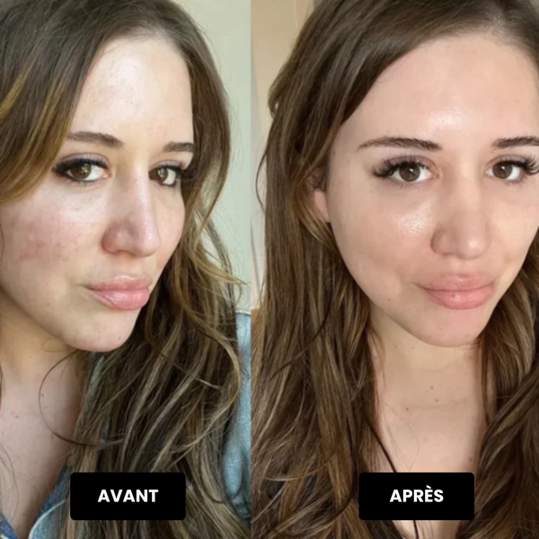 Effet peau de bébé, je suis bluffée