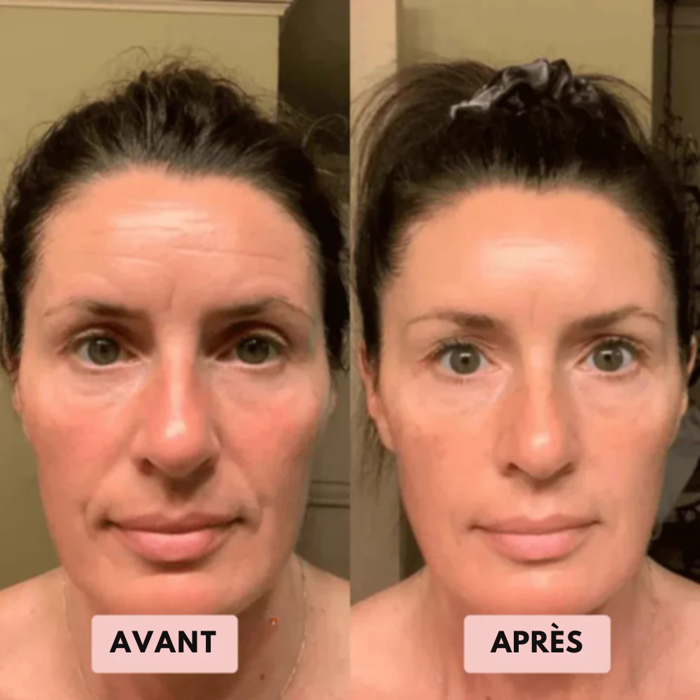 Ovelia - Gommage au riz