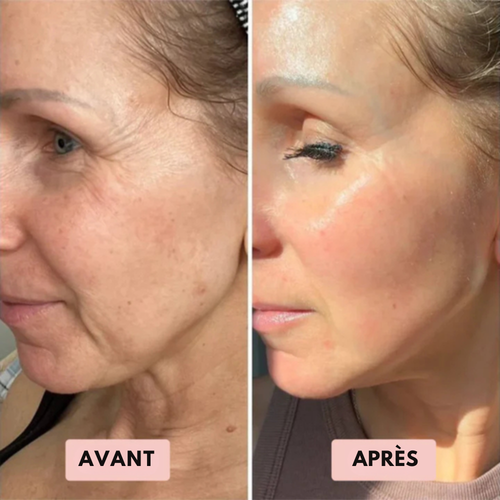 Ovelia - Gommage au riz