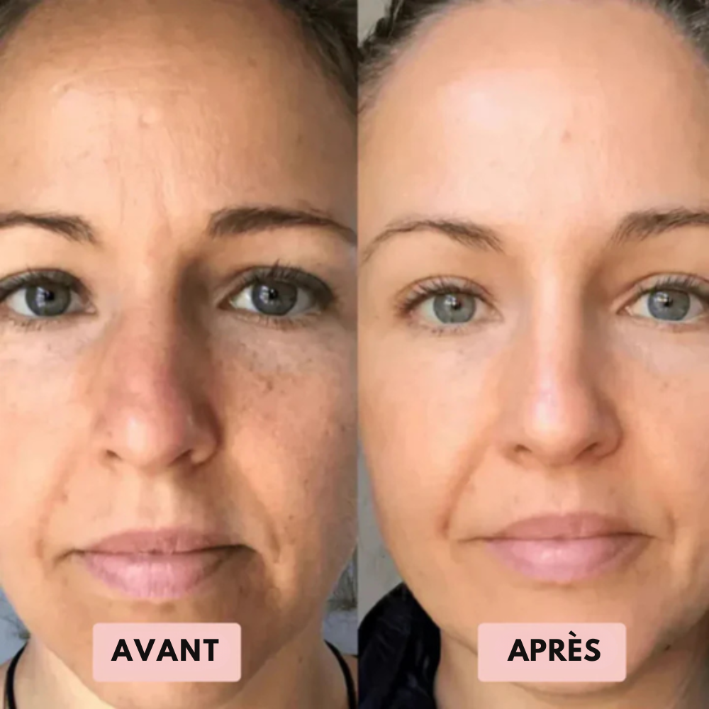 Ovelia - Gommage au riz