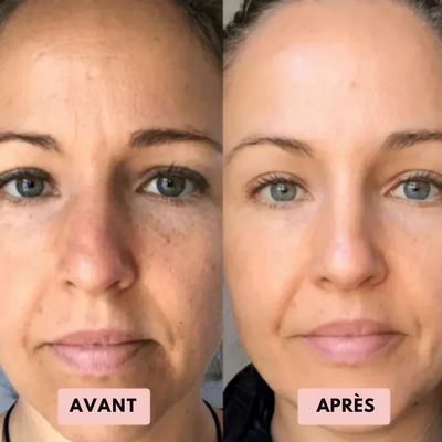 Ovelia - Gommage au riz