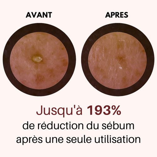 Ovelia - Gommage au riz