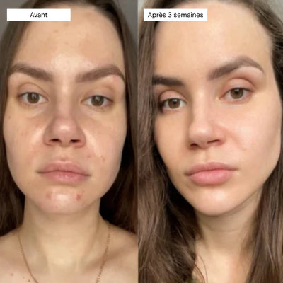 Retinal Shot - Sérum Booster Anti-Âge