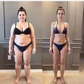 Patch minceur Ovelia