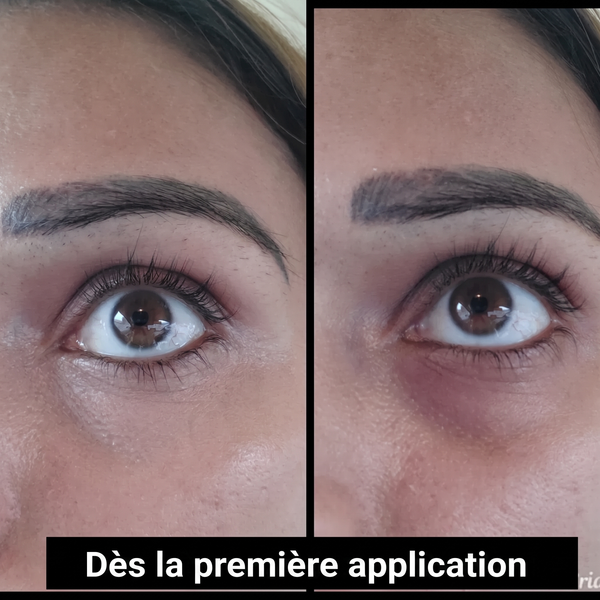 Tout le violet sous mes yeux a disparu